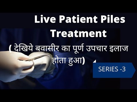 How the Patient of Piles is Treated? प्रत्यक्ष देखे कैसे बवासीर के रोगी का इलाज होता है ? Series 3