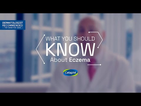 What You Should Know About Eczema | Ask the Experts​