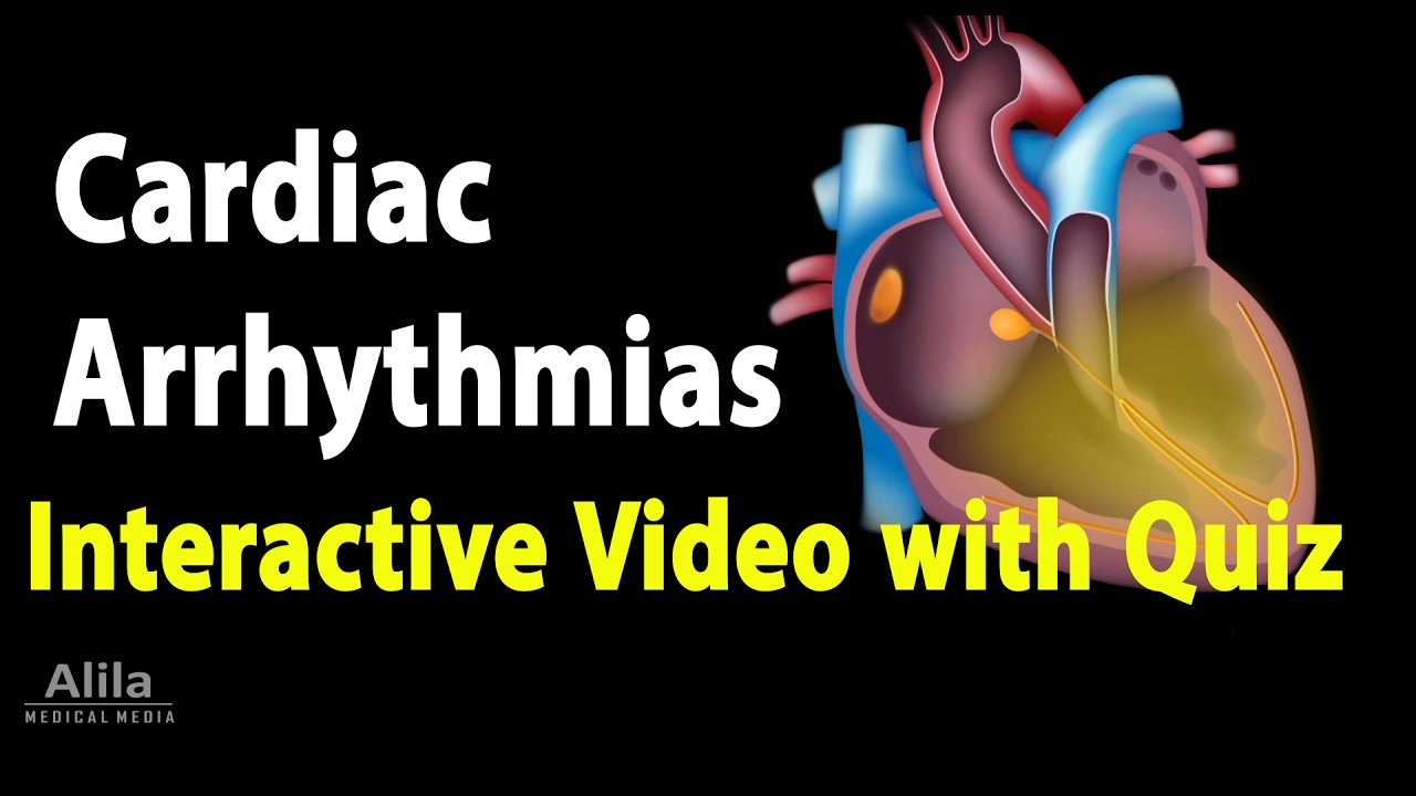 NEW: INTERACTIVE Animation with Quiz: Cardiac Arrhythmias
