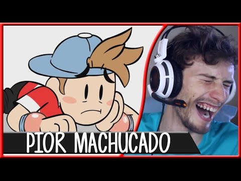 REACT O PIOR MACHUCADO DA MINHA VIDA ☆ PARTE 2 ☆ | Gato Galactico