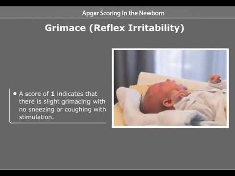Apgar Scoring In The Newborn
