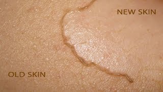 How To Remove Dead Skin Naturally At Home | Home Remedies