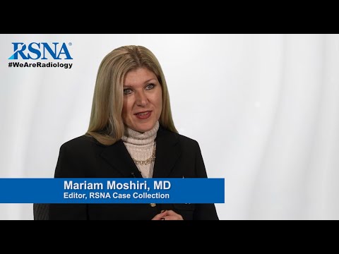 RSNA Interview with Maryam Moshiri, MD