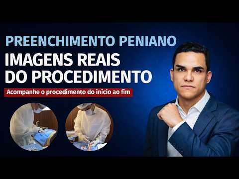 Dr. Rafael explica