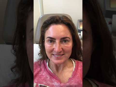 Botox Before and After Natural Results #aestheticdermatology