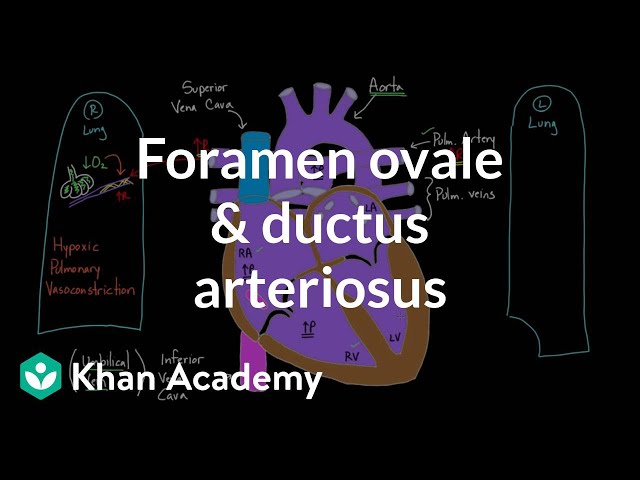 Videouttalande av foramen ovale Engelska