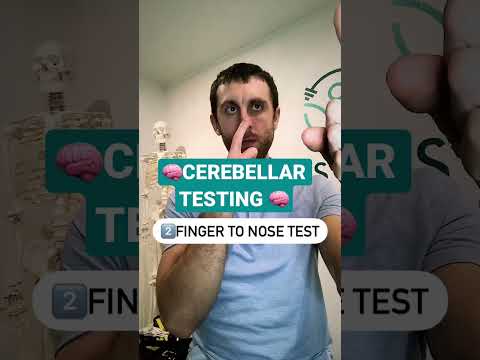 🧠Cerebellar (Coordination) Testing #shorts