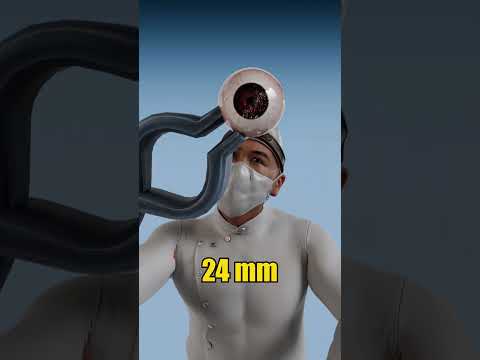 Gorilla Eyes vs Phoenix Eyes