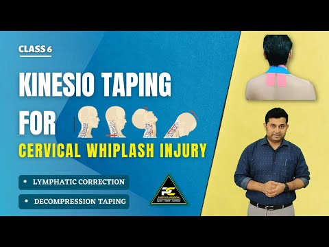 Try this if you have Neck Pain physiotherapy neckpaintreatment