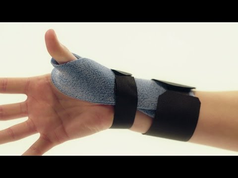Orthosis for De Quervain’s Tenosynovitis - Orficast Instructional Movie 19