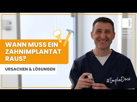 Wann muss ein Zahnimplantat raus? Häufige Ursachen und Lösungen | Carree Dental Köln