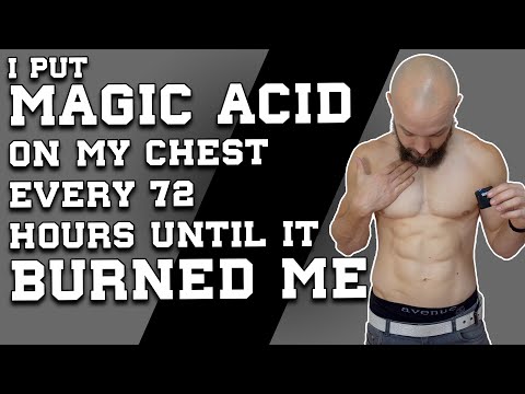 Veet Men Hair Removal Cream - Extended Use Review