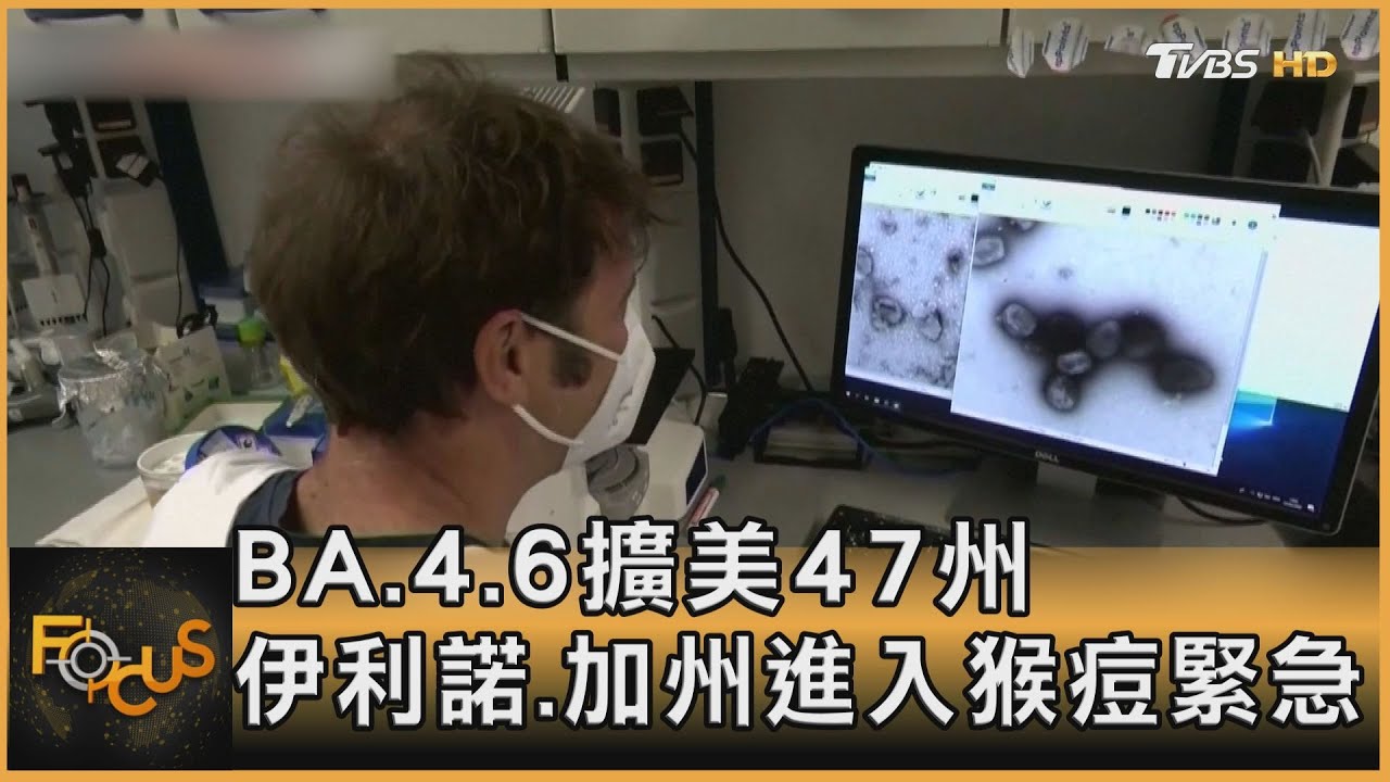 BA.4.6擴美47州 伊利諾.加州進入猴痘緊急