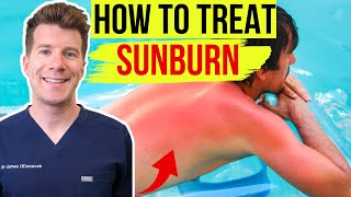 Doctor explains HOW TO TREAT SUNBURN | Top 5 things to do & avoid to help your skin