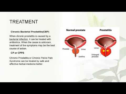 Tinktur der Rosskastanie Behandlung von Prostatitis Chronische Prostatitis medikamentöse Behandlung