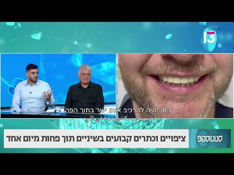 ציפויים וכתרים בשיניים תוך פחות מיום אחד