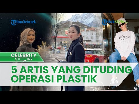 5 Artis Ini Dituding Lakukan Operasi Plastik seusai Penampilannya Semakin Cantik, Ada Ria Ricis