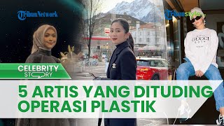 5 Artis Ini Dituding Lakukan Operasi Plastik seusai Penampilannya Semakin Cantik, Ada Ria Ricis