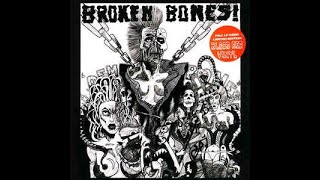 Download lagu Broken Bones ‎– Dem Bones LP (1984) [VINYL RIP] *HQ AUDIO* mp3