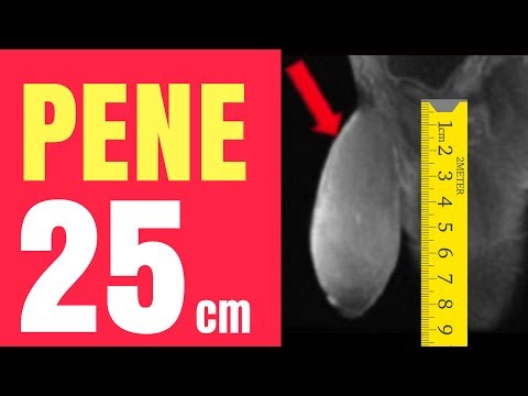 Le donne più potenti del eccitatore gocce recensioni Un intervento chirurgico sul pene