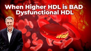 When Higher HDL is BAD - Dysfunctional HDL