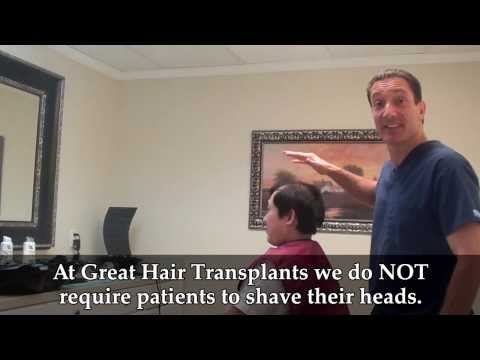 Do I Need to Shave My Head for a Hair Transplant? Video