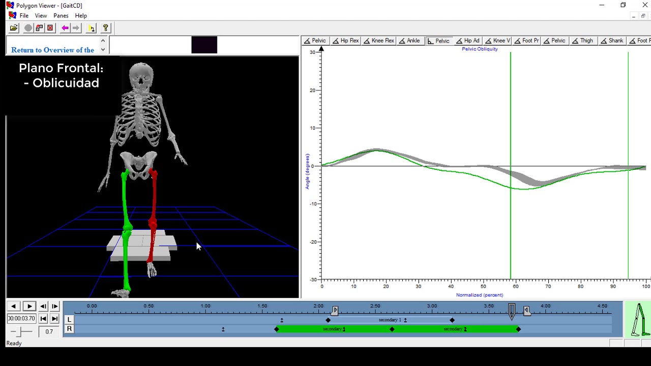 Cinemática de la pelvis durante la marcha