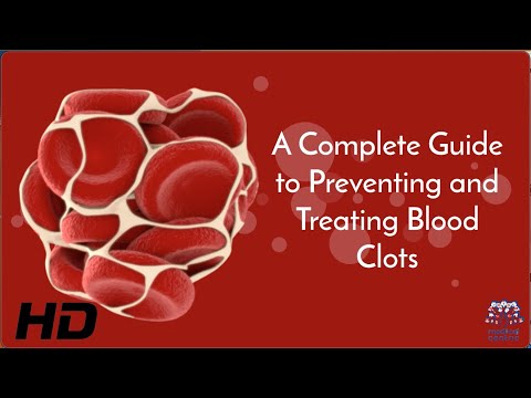 Pernicious Anemia Causes Signs and Symptoms Diagnosis and Treatment