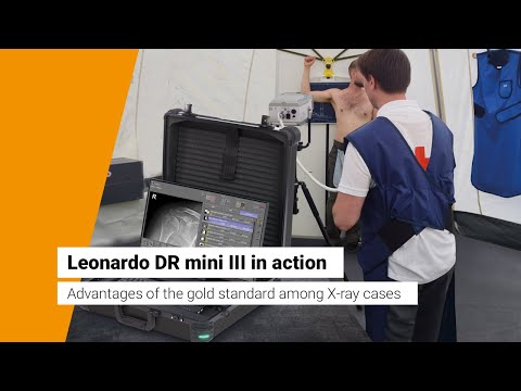 Leonardo DR mini III - the goldstandard among portable X-ray systems