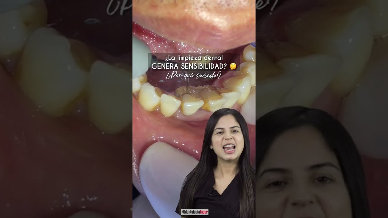 Sensibilidad Dental Luego de una Limpieza Dental - Odontología Láser #Shorts