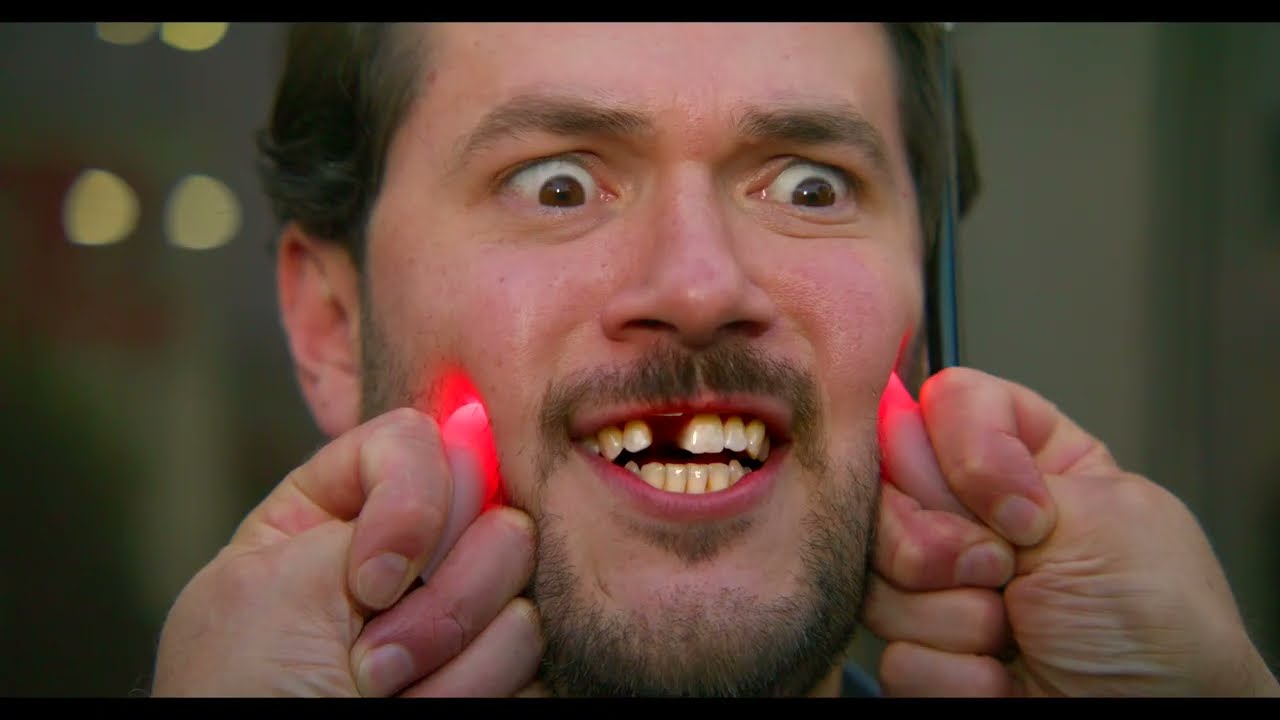 Open video