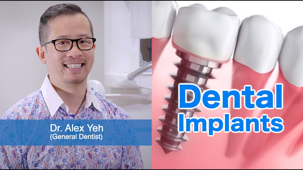 What They Don T Tell You About Dental Implants