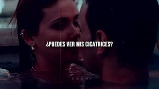 Soundtrack Teaser Culpa Mia// Scars- Boy Epic -traducido