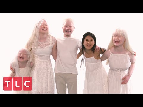 The Grabowskis' Unique Adoption Story (Part 2) | Born With Albinism
