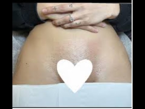 BRAZILIAN BIKINI LINE HARD WAXING FOR BEGINNERS #viral #brazilian #sugaring #wax