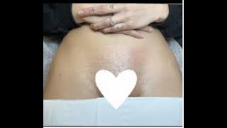 Download lagu BRAZILIAN BIKINI LINE HARD WAXING FOR BEGINNERS #viral #brazilian #sugaring #wax mp3