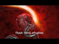 Onyx HD 500 LES Animation Wmv
