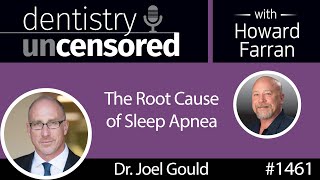 1461 Dr. Joel Gould on the Root Cause of Sleep Apnea : Dentistry Uncensored with Howard Farran