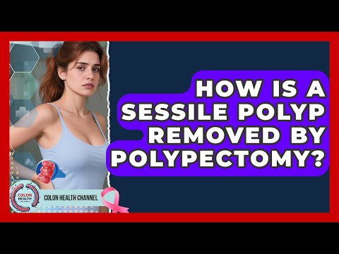 How Is A Sessile Polyp Removed By Polypectomy? - Colon Health Channel