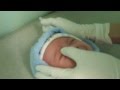 Массаж при дакриоцистите новорожденных 