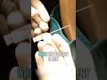 SpinE Injection Nerve Block Shorts