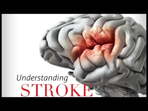 Stroke Setbacks During Our Recovery