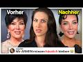 Die Hässliche Wahrheit Hinter Kris Jenners Neuem Gesicht