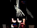 Ankle injury - Ankle fracture animated - Broken ankles