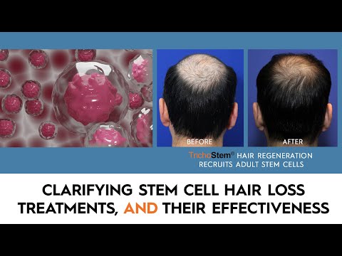 What You Need to Know About Stem Cell Hair...
