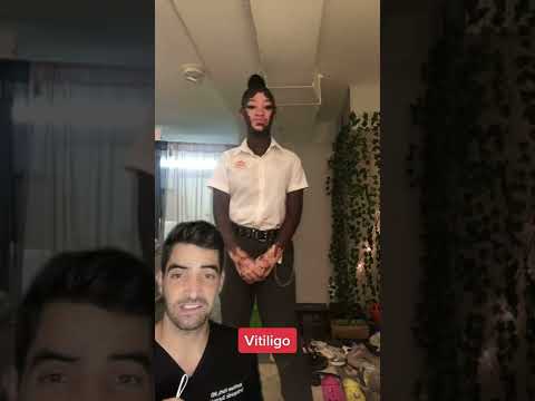 Autoimmune Diseases, Vitiligo