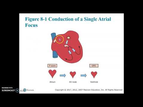 Cardiac Chapter 8 Video 1