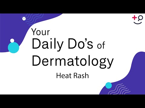 Heat Rash - Daily Do's of Dermatology