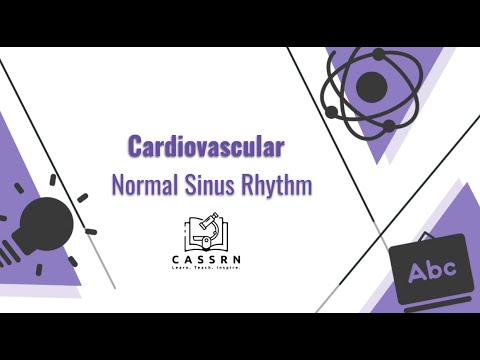 Normal Sinus Rhythm