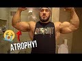 My bicep atrophied!